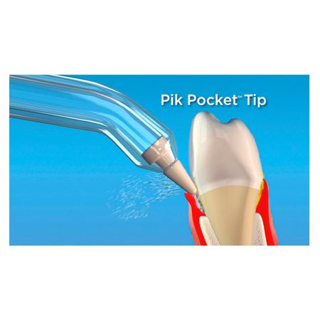 Bico-para-Limpeza-de-Gengiva-Waterpik---Pik-Pocket-2-Un--2