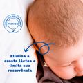 Creme Infantil Mustela Bebê Stelaker Crosta Láctea 40ml