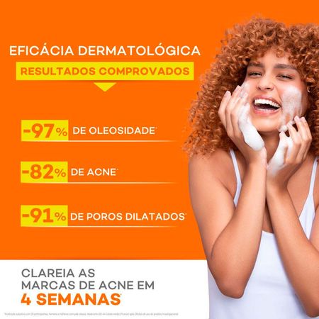 https://epocacosmeticos.vteximg.com.br/arquivos/ids/492663-450-450/gel-de-limpeza-darroe-actine-vitamina-c-60g-6.jpg?v=637904032417300000