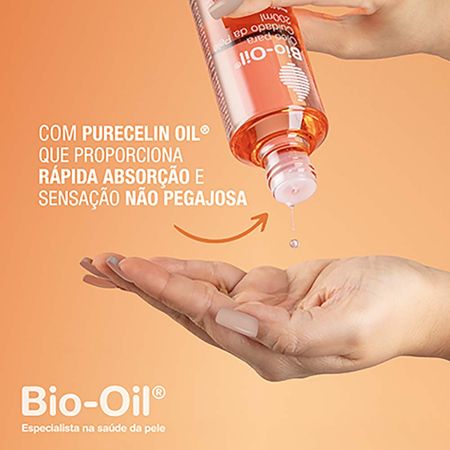 https://epocacosmeticos.vteximg.com.br/arquivos/ids/507075-450-450/bio-oil-tratamento-antiestrias--1---3-.jpg?v=637977520630000000