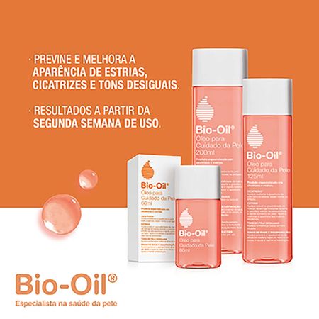 https://epocacosmeticos.vteximg.com.br/arquivos/ids/507079-450-450/bio-oil-tratamento-antiestrias--1---5-.jpg?v=637977520993300000