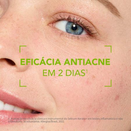 https://epocacosmeticos.vteximg.com.br/arquivos/ids/529552-450-450/gel-creme-antiacne-e-anti-marcas-bioderma-sebium-kerato--2-.jpg?v=638084553766000000