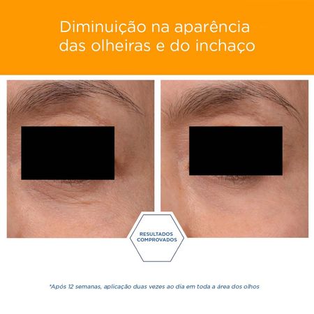 https://epocacosmeticos.vteximg.com.br/arquivos/ids/531019-450-450/creme-para-olhos-neostrata-bright-eye--4---6-.jpg?v=638094775800570000