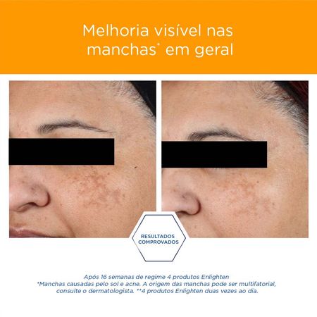 Loção-Clareadora-Facial-Neostrata---Pigment-Controller-50ml--8