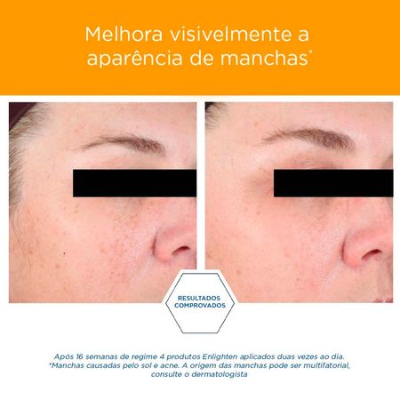 https://epocacosmeticos.vteximg.com.br/arquivos/ids/534378-450-450/Illuminating-Enlighten-Neostrata---Serum-Clareador-Facial---30ml-4--3---7-.jpg?v=638109399952400000