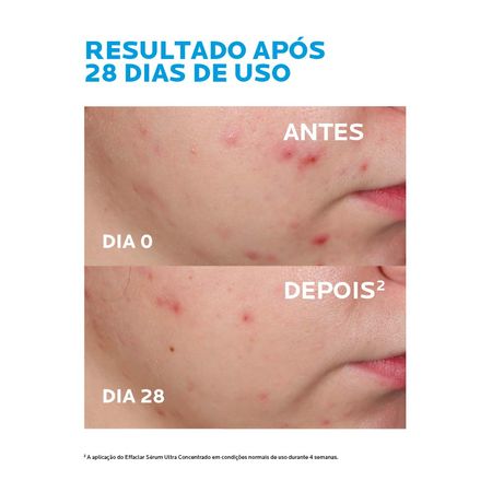 https://epocacosmeticos.vteximg.com.br/arquivos/ids/549976-450-450/serum-facial-la-roche-posay-effaclar-ultra-concentrado--7-.jpg?v=638198434944200000