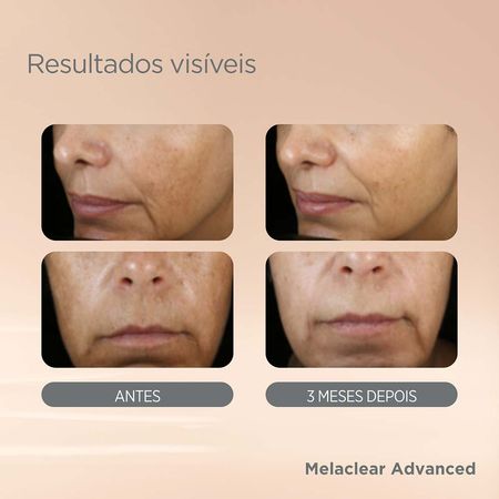 https://epocacosmeticos.vteximg.com.br/arquivos/ids/571146-450-450/serum-facial-clareador-isdin-melaclear-advanced--1---2-.jpg?v=638315344347170000