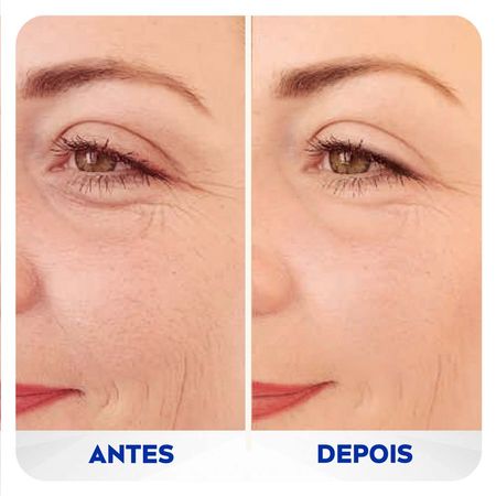 https://epocacosmeticos.vteximg.com.br/arquivos/ids/571870-450-450/creme-preenchedor-facial-nivea-q10-expert-antissinais--5-.jpg?v=638319455845500000