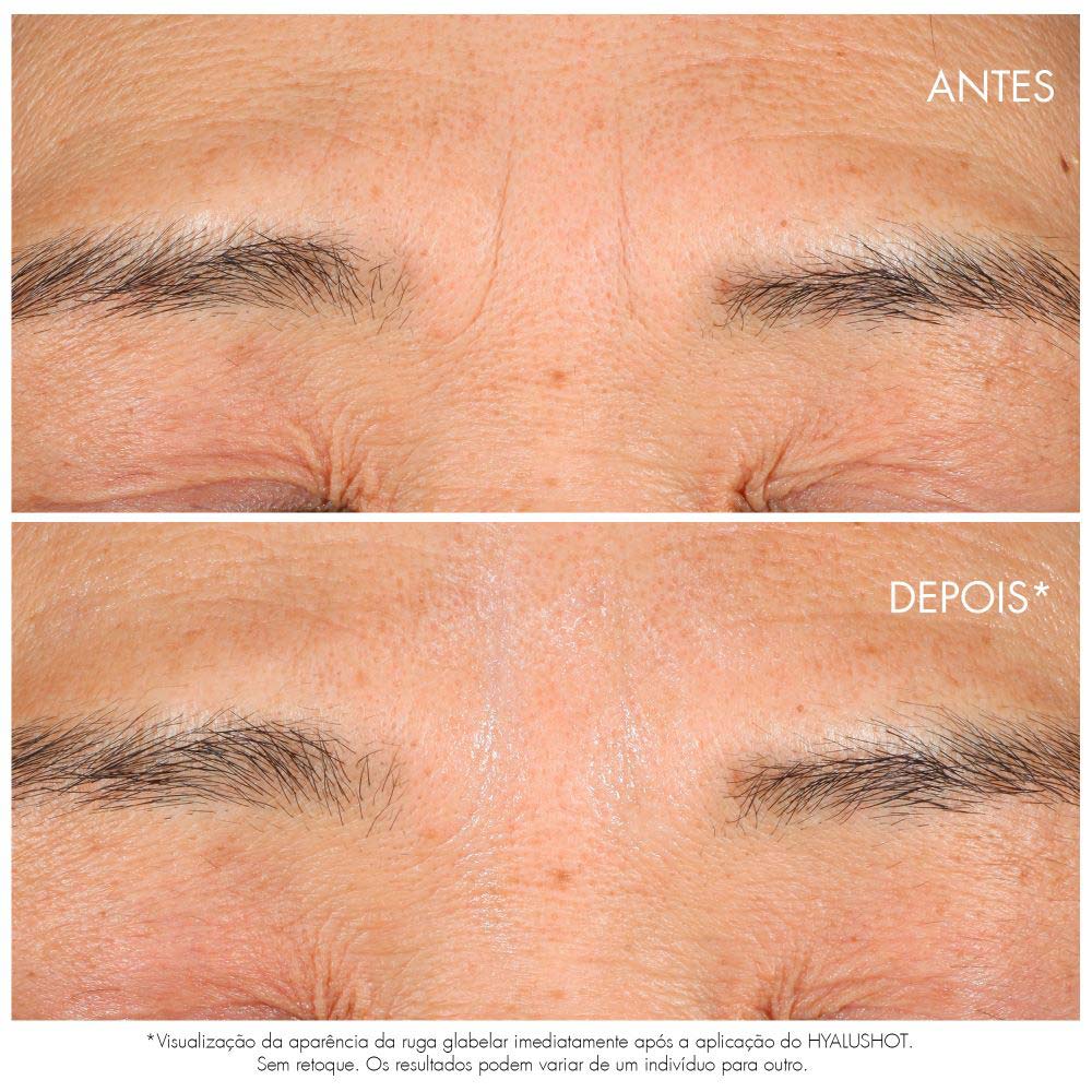 Corretor Multirrugas Dior Capture Totale Hyalushot