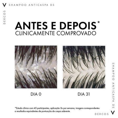 Vichy-Dercos-Shampoo-Anticaspa-DS---Cabelos-Normais-a-Oleosos-Refil-200g--4