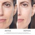 Lancôme Rénergie Kit - Sérum + Creme de Olhos + Creme Diurno + Creme Noturno Kit