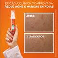 Creme Facial Renovador Antiacne Darrow Actine Renov Concentrado 30 g