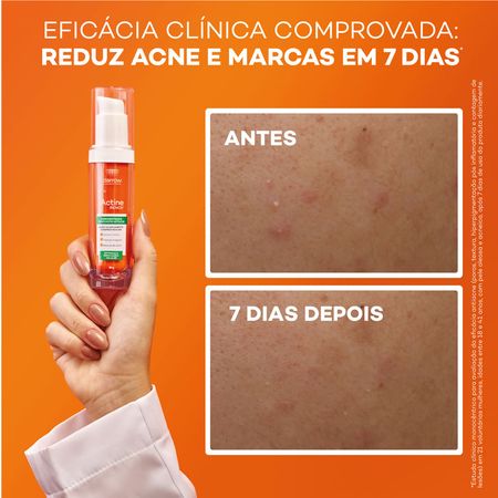 Creme-Facial-Renovador-Antiacne-Darrow-Actine-Renov-Concentrado-30-g--7