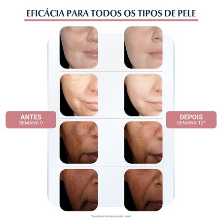 Creme-Facial-Clareador-Eucerin-Anti-Pigment-FPS-30-50-ml-50-ml--7
