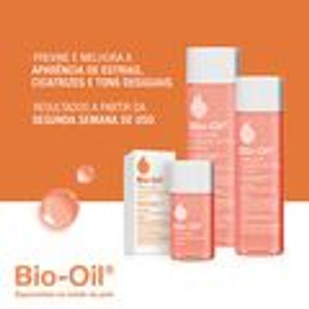 https://epocacosmeticos.vteximg.com.br/arquivos/ids/691712-450-450/bio-oil-tratamento-antiestrias--1---5-.jpg.jpg?v=638654798973470000