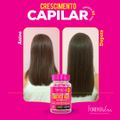 Forever Hair Crescimento Capilar Tratamento 30 Dias 30 Caps