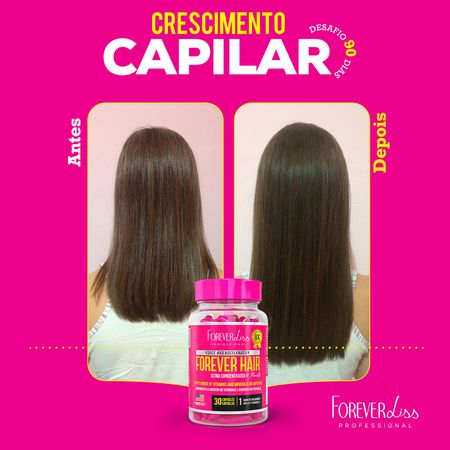 Combo-Tratamento-3-Meses-Forever-Hair-Crescimento-Capilar-150g--2