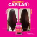 Combo Tratamento 3 Meses Forever Hair Crescimento Capilar 150g