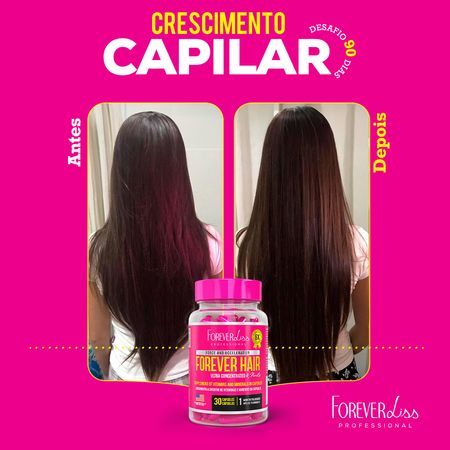 Combo-Tratamento-3-Meses-Forever-Hair-Crescimento-Capilar-150g--3