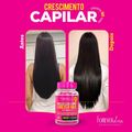 Combo Tratamento 3 Meses Forever Hair Crescimento Capilar 150g
