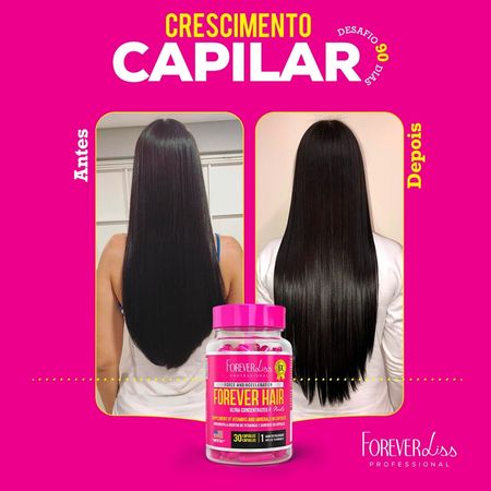 Combo-Tratamento-3-Meses-Forever-Hair-Crescimento-Capilar-150g--6