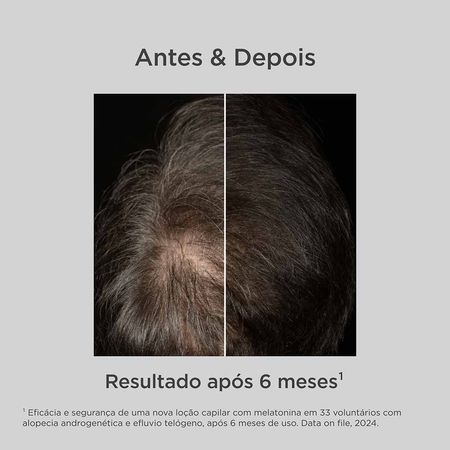 Isdin-Hair-Care-Loção-Antiqueda-Melatonin-Concentrate-100ml--3