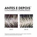 Vichy Dercos Shampoo Anticaspa DS - Cabelos Secos 300g
