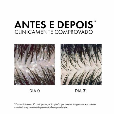 Vichy-Dercos-Shampoo-Anticaspa-DS---Cabelos-Secos-Refil-200g--5