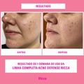 Sabonete Líquido Facial Acne Defense Ricca