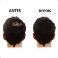 Kit Vertix: 3 Fibras Capilar Castanho Escuro 25g