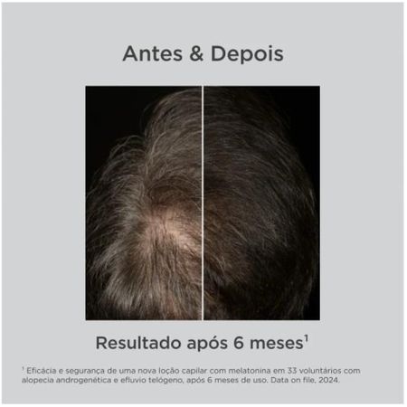 Loção-Antiqueda-Isdin-Haircare-100ml--4