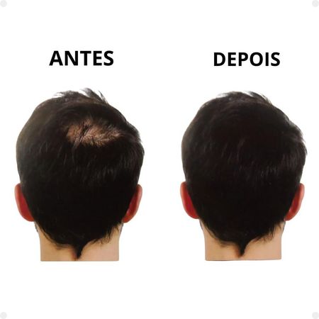 Kit-Vertix:-3-Fibras-Capilar-Loira-25g--7