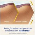 Nivea Luminous 630 Creme Corporal Antimarcas 200ml