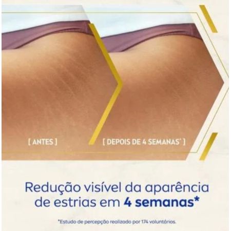 Nivea-Luminous-630-Creme-Corporal-Antimarcas-200ml--5