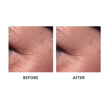 Liftactiv-Colágeno-Specialist-Creme-Facial-Vichy-50ml--3