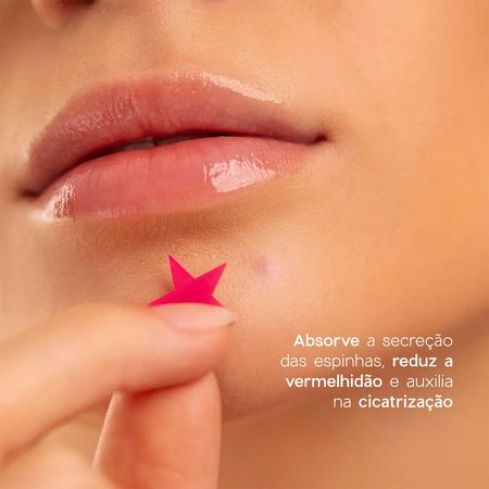 Océane-4You-Star-Acne-Patches---Adesivos-Secativos-para-Espinhas--3