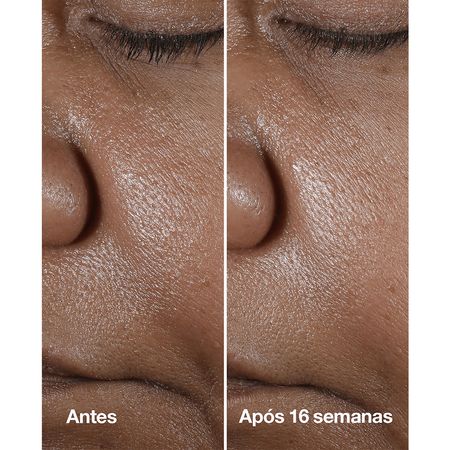 Clinique-Smart-Clinical-Repair---Sérum-Redutor-de-Linhas-30ml-30ml--7