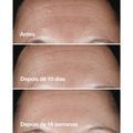 Clinique Smart Clinical Repair - Sérum Redutor de Linhas 30ml 30ml