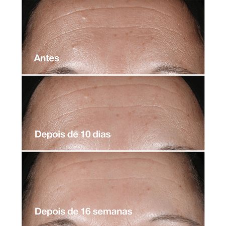 Clinique-Smart-Clinical-Repair---Sérum-Redutor-de-Linhas-30ml-30ml--9