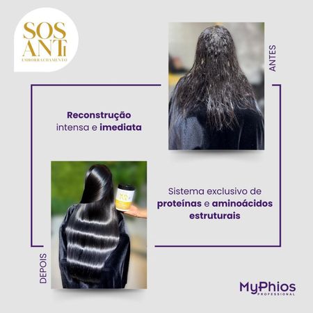 MyPhios-SOS-Antiemborrachamento-Condicionador-300ml--2