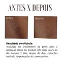 Inibidor de Pelos Labotrat Dermo Skin Facial e Corporal 140ml