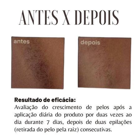 Inibidor-de-Pelos-Labotrat-Dermo-Skin-Facial-e-Corporal-140ml--6