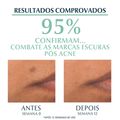 Sérum Facial Tripla Ação com Thiamidol Eucerin Dermo Pure Oil Control 40 ml 40 ml